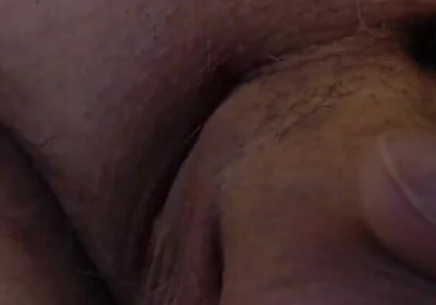 Limping Dick