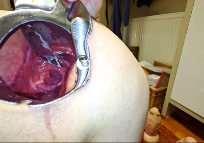Extreme Anal Speculum Opening My Anal Canal!