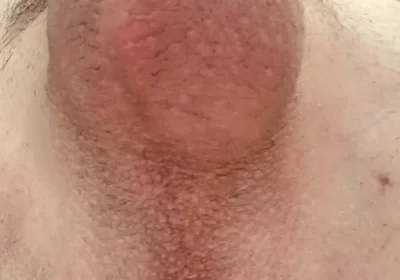 Do You Like Shaved or Hairy?