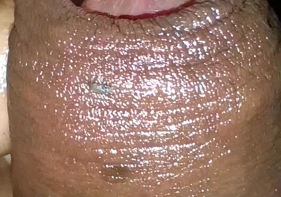 Close-up of Foreskin and Ejaculation in My Pants