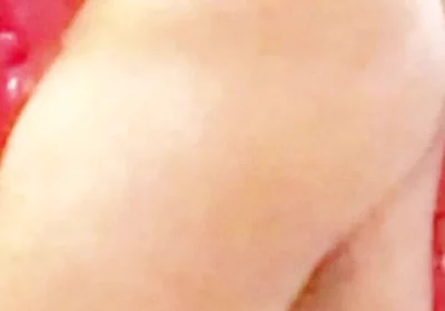 Whip-lash