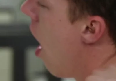 Exposed