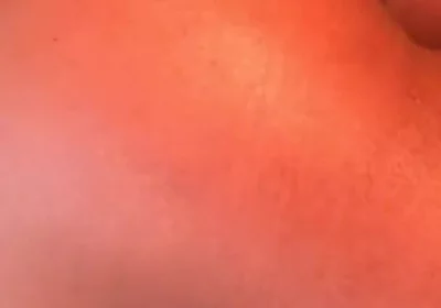 Bubble Butt