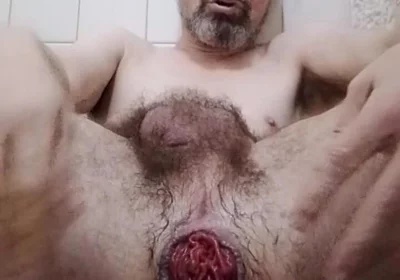 July Prolapse Progress
