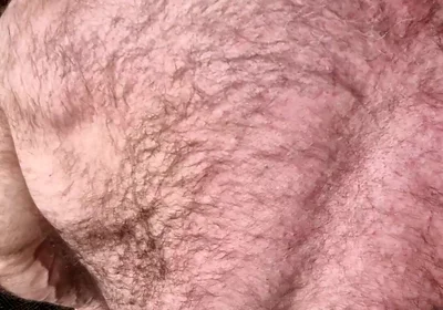 Hairy Muscle Back