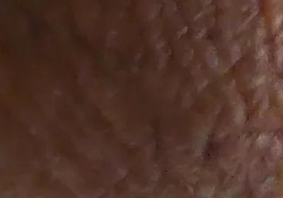 Closeup Desi Dick
