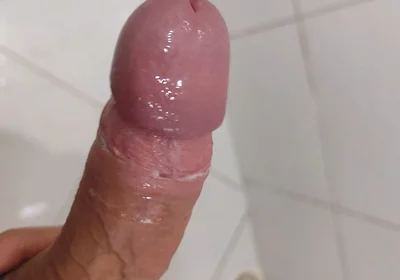 Strong Water in the Foreskin Excites the Glans Precum.
