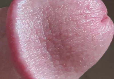Closeup of Penis with One Vein