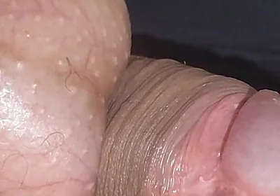 Amazing Upright Rough Venous Frenulum.