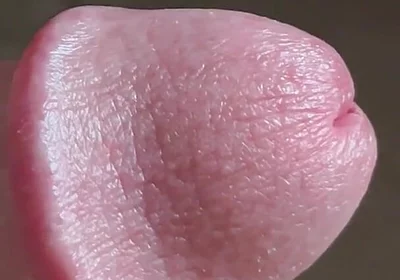 Closeup of Penis with One Vein