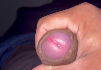 My Penis