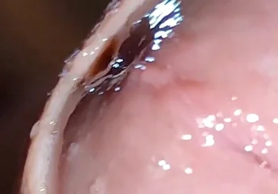 Glans Eye Watering After Intense Fucking.