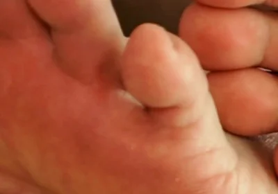 The Foot Master's Installation Protocol