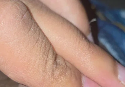Closeup