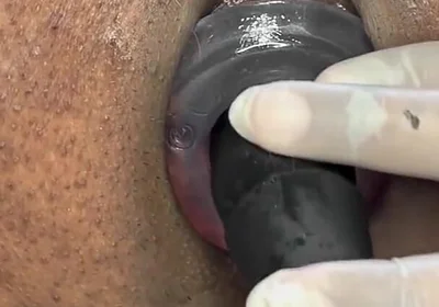 Ass Gape