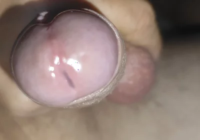 Scrotal Phimosis Results in an Extremely Hot Orgasm.