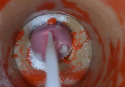 Insemination - Internal Camera Captures Deep Male Ejaculation