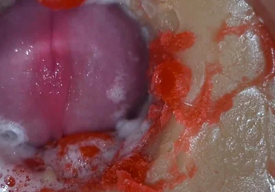 Insemination - Internal Camera Captures Deep Male Ejaculation